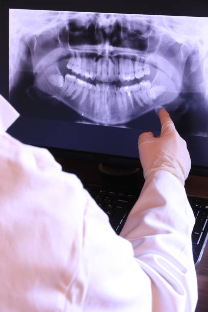 Best Emergency Dental Care for Broken or Chipped Teeth in Clarion, PA
